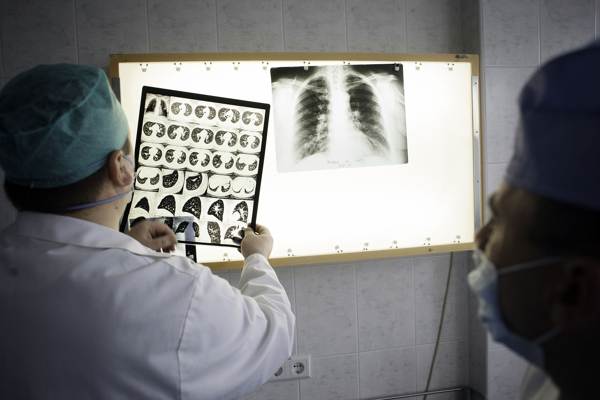 Tuberkulose in Moldawien